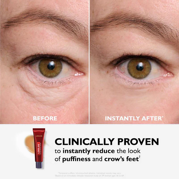 🔥Eye Bag Eraser